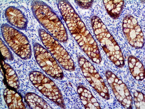 IHC of MUC-4 on an FFPE Colon Tissue